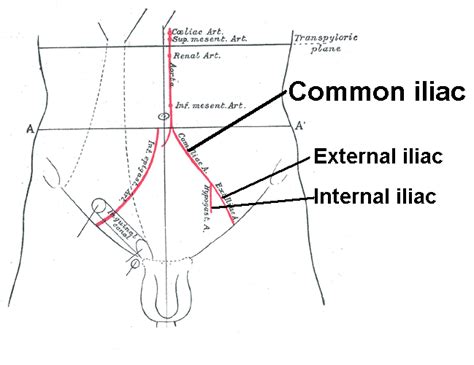 Internal iliac artery - Wikiwand