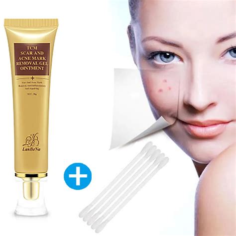 Aliexpress.com : Buy Acne Scar Stretch Marks Remover Cream Skin Repair ...