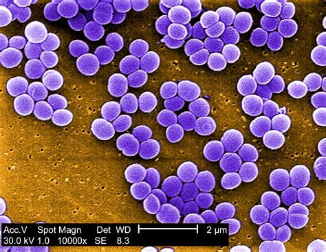 Free picture: staphylococcus aureus, bacteria, vancomycin, intermediate ...