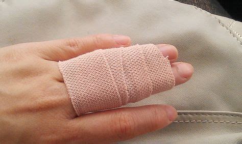 Sprained Finger | treatment, taping and recovery with P.R.I.C.E principle