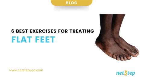 6 Best Exercises For Treating Flat Feet - netStep