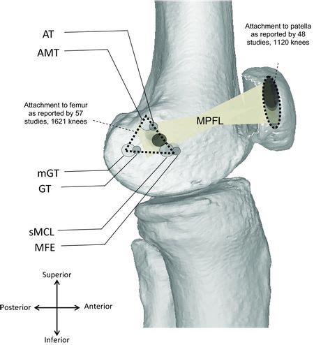 Medial Patellofemoral Ligament (MPFL) - Physiopedia