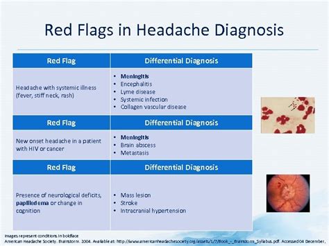 KNOW MIGRAINE PAIN Migraine Module Development Committee