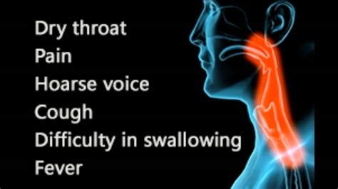 Throat Infection – Telegraph