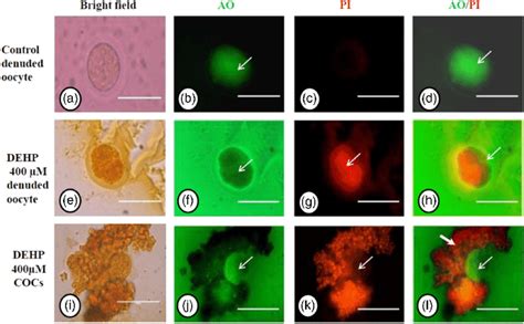 Representative photographs showing acridine orange/PI staining for ...