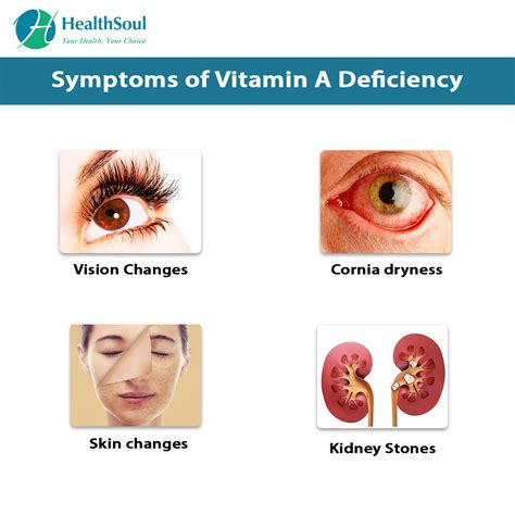 Un anumit cupru unpleasantly vitamin a deficiency symptoms Interpret ...