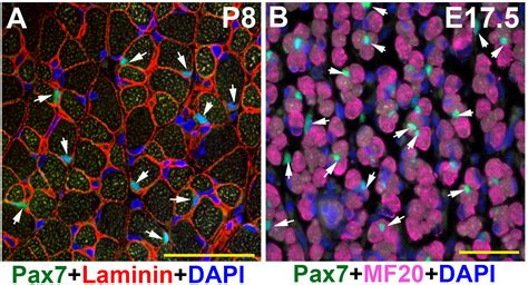 Identification of Skeletal Muscle Satellite Cells by Immunofluorescence ...