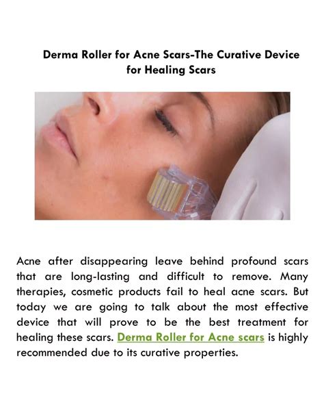 PPT - Derma Roller for Acne Scars-The Curative Device for Healing Scars ...