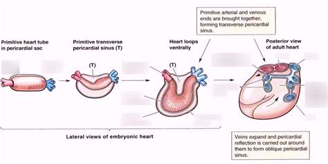 Transverse sinus and Oblique Sinus Diagram | Quizlet