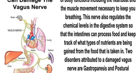 Chiari vagus nerve damage | Syringomyelia/Syrinx/Chiari | Pinterest ...