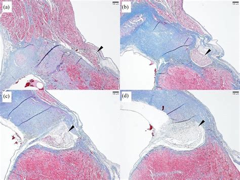 Heart Valve Histology