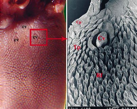 Filiform Papillae White