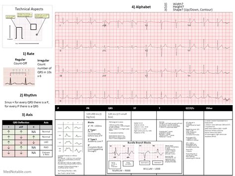 Ecg Interpretation Cheat Sheet | Images and Photos finder