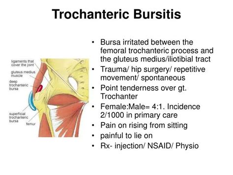 Anterior Hip Bursitis