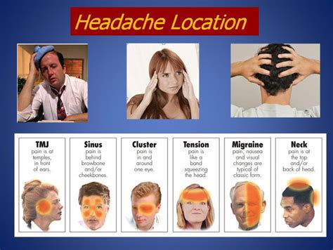 headaches - Google Search | Headache location, Headache, Headache chart