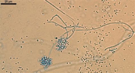 22 Spores of Beauveria bassiana on conidiophores (photo: Sarah Thomas ...