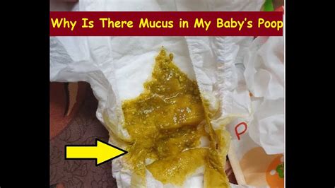 Why Is There Mucus in My Baby’s Poop? - YouTube