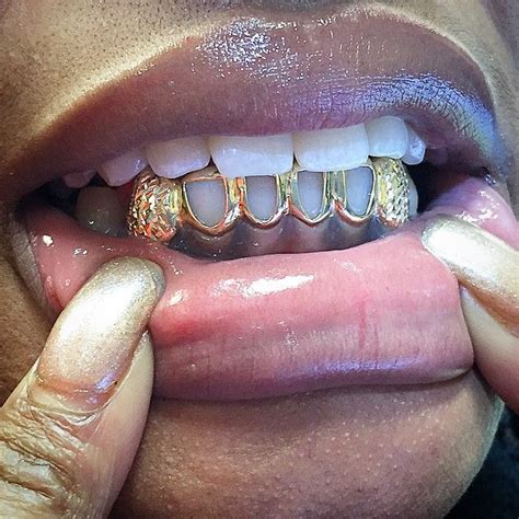 tooth grills for women - Google Search.... Take a look at more at the ...