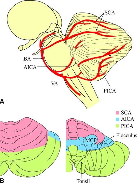 Posterior Cerebral Circulation Anatomy