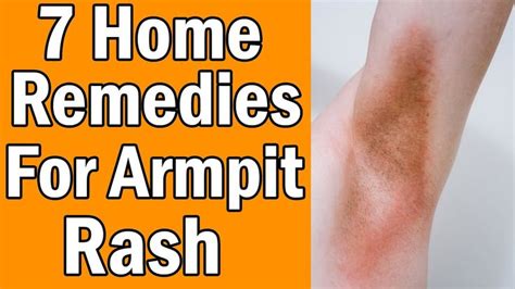 How To Heal Armpit Rashes In 2020 Armpit Rash Remedies Home Remedies ...