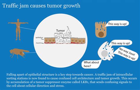 Cancer research – how a traffic jam causes tumor growth