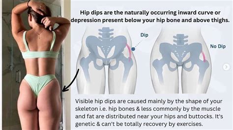 Hip Dips: What Are They, And The Exercises To Reduce Their, 48% OFF