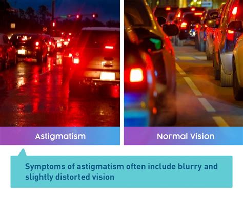 What Is Astigmatism & Everything You Need to Know — UNIQSO