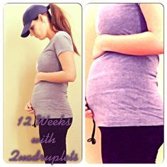 My Pregnancy with Quadruplets