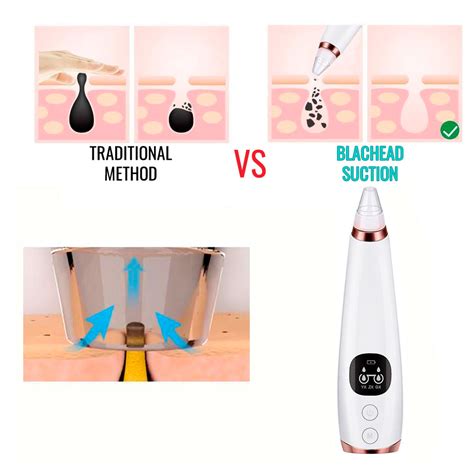 Blackhead Removal Vacuum Suction Kit – THEBEAUTYLAB