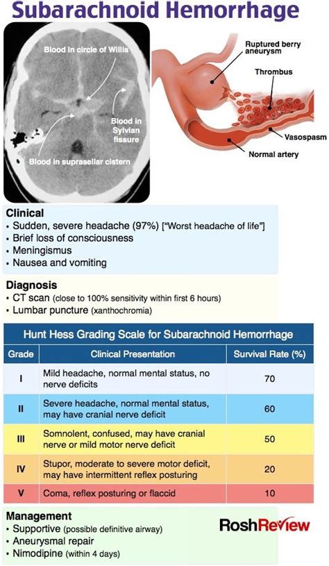 Headache Red Flags Mnemonic - Headache