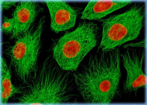 Visualizing the Proximity Between the Microtubule Network and the ...