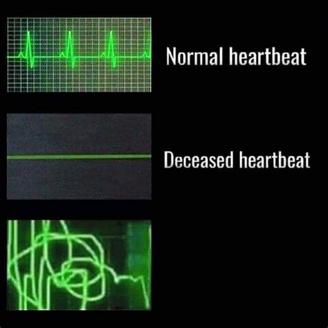 Heartbeat Blank Template - Imgflip