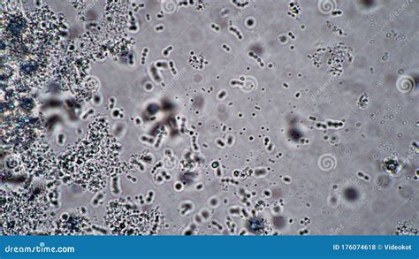 Adjusting the Focus of the Microscope on Lacto Bacteria and Bacilli ...