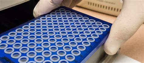 DNA analysis device a game-changer for researchers | SOURCE