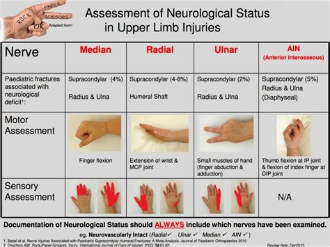 Median Nerve Palsy