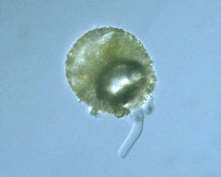 Protist Images: Difflugia