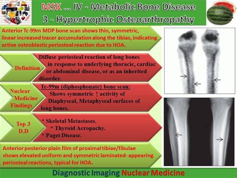 Easy Radiology: Metabolic bone disease