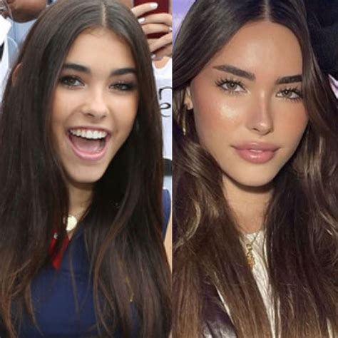 Madison Beer plastic surgery | Plastic surgery, Madison beer plastic ...