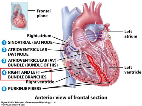 Accessory Atrioventricular Bundle; Bundle of Kent