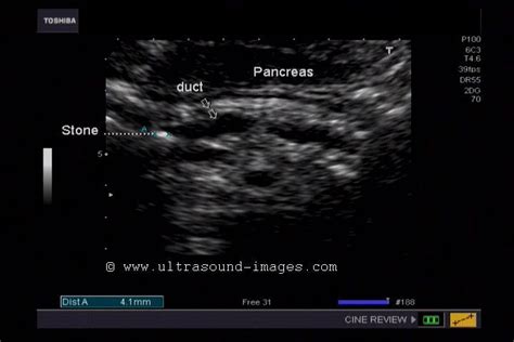 A Gallery of High-Resolution, Ultrasound, Color Doppler & 3D Images ...