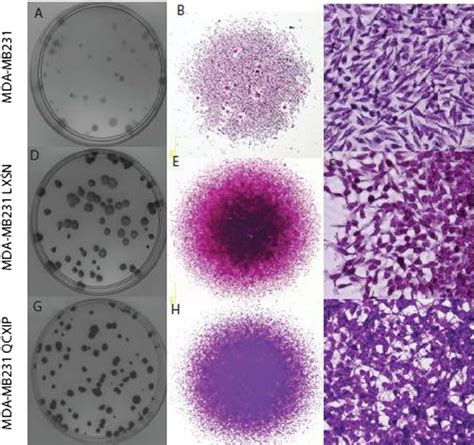 Retroviral infection alters the colony appearance and morphology of ...