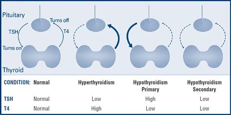 Pediatric Thyroid Function Tests | American Thyroid Association