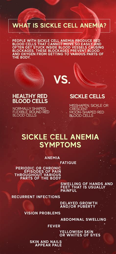 Sickle Cell Anemia: Cause, Symptoms and Treatment – The Amino Company