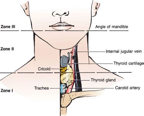 Penetrating Neck Trauma | Anesthesia Key