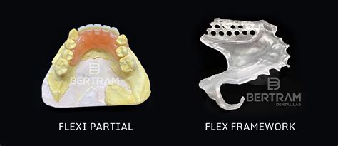 Flex Clasps & Frameworks - Bertram Dental Lab