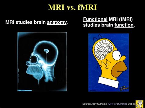 PPT - Functional Magnetic Resonance Imaging ; What is it and what can ...