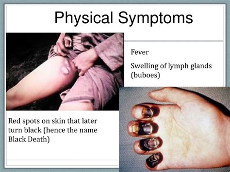 The Black Death Symptoms