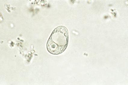 Iodamoeba Butschlii Life Cycle