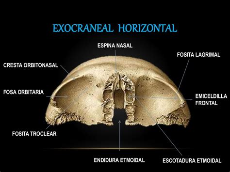 Hueso frontal