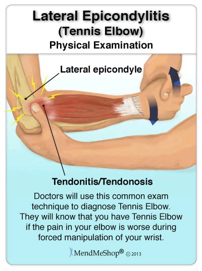 Pitcures Of The Tendons In Tbe Forearm / Elbow/Forearm Tendon Ligament ...